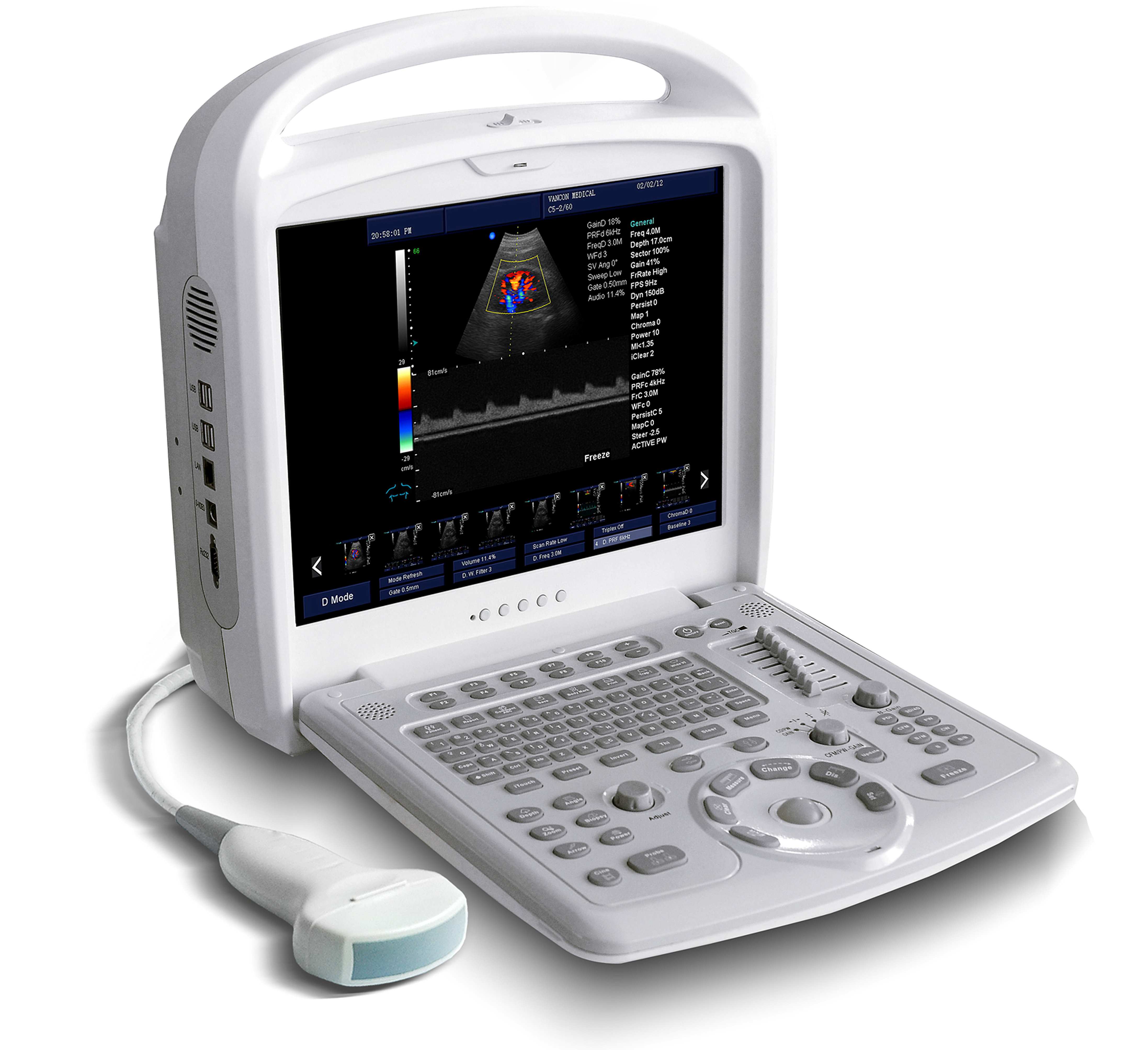 color ultrasounds